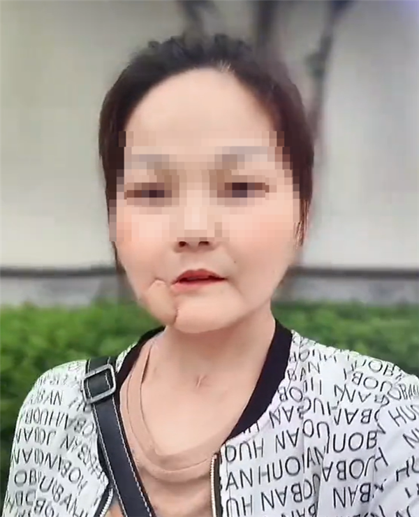 嚼槟榔10年患口腔癌的博主离世:一级致癌物、不吃为妙