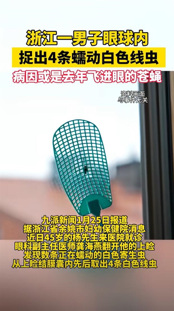 男子眼球内捉出4条蠕动线虫:左眼曾飞进去过一只苍蝇