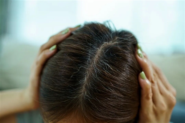 白头发别急着拔!重新变黑发的方法找到了