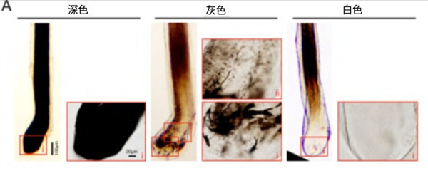 白头发别急着拔!重新变黑发的方法找到了