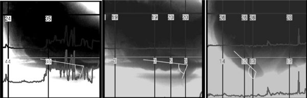 上厕所 坐着好还是蹲着好?最佳姿势竟然是……