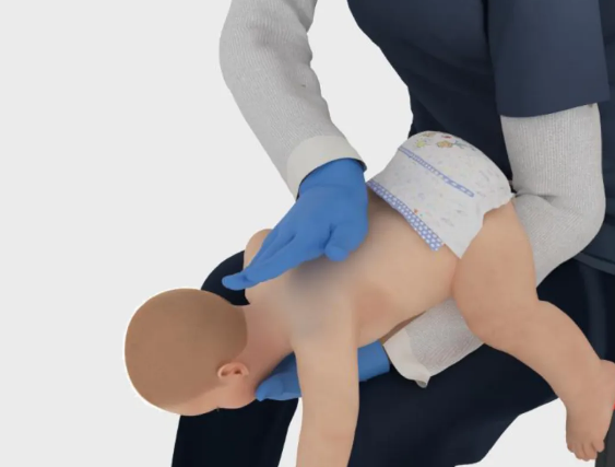 海姆立克急救法更新了：先拍5次背 再做“剪刀石头布”