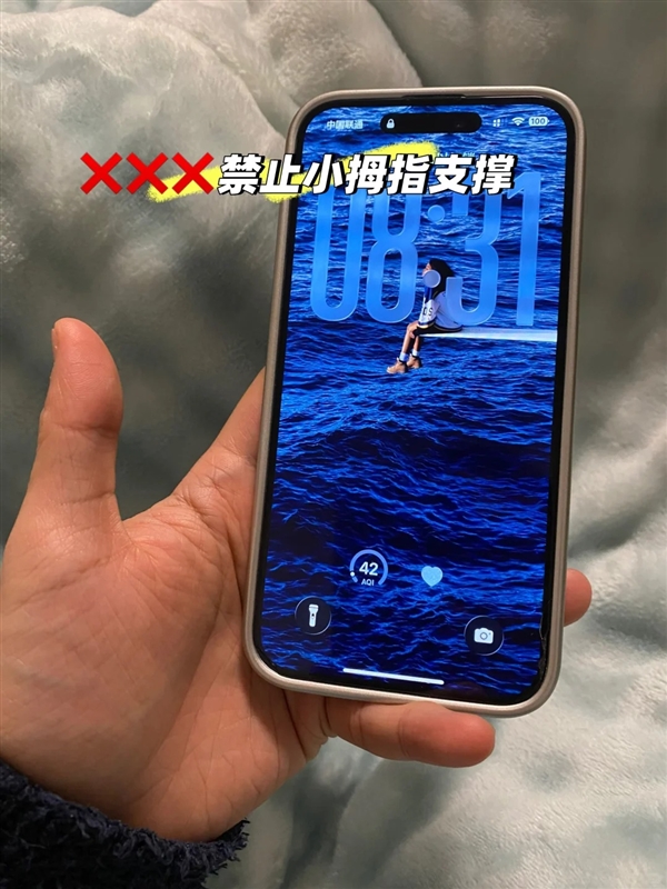 用小拇指做手机支架的受害者出现了:手指出现明显凹痕
